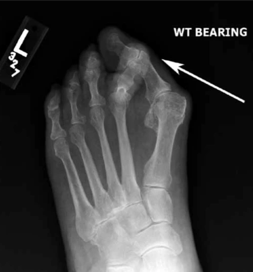 AD_4nXd3Zs74c1csuXceEmo86NQ3PhrNh4TrRdndkoV2WwcgatiCIuBTeJKH2elHDgHBBOa0Wu_76-2n6Z-0mbt8T3VgZMhU2yHXhDGwZ9svYSs8_VEIXu9k9B7RS7hU_pwpyQSEyZtNBg?key=AhLvapB3KLbFMHGKEOaM91Xy