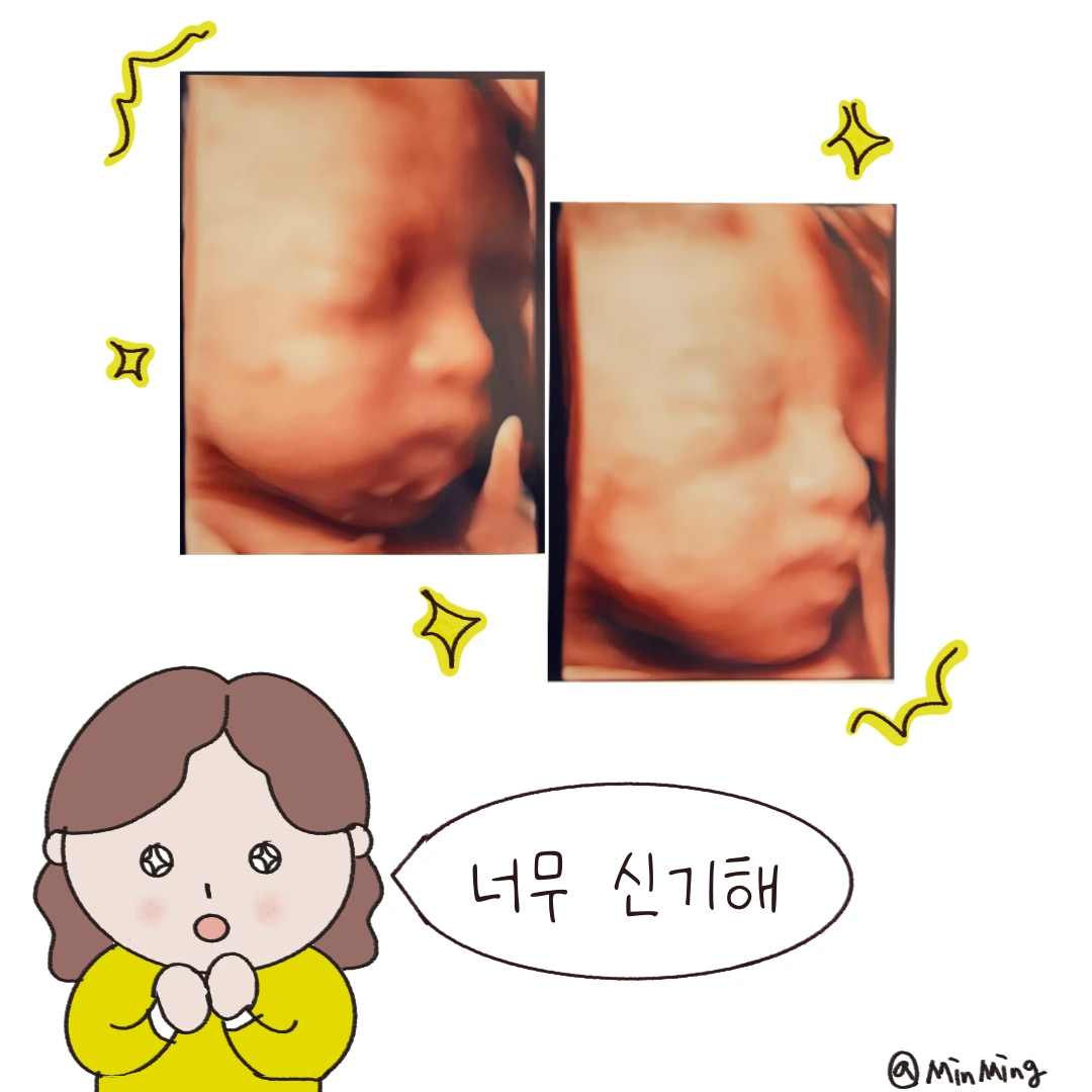 제목_없는_아트워크-8 3.PNG