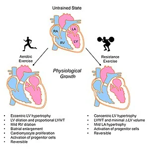 Exercise-induced_cardiac_growth_-_Cardiac_remodeling_from_Aerobic_and_Resist.jpg?type=w580