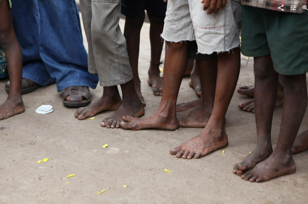 인도슬럼가_맨발의 아이들.PNG