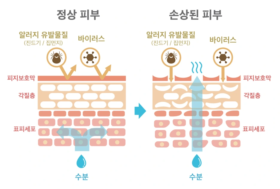 %ED%94%BC%EB%B6%80%EB%B3%B4%ED%98%B8%EB%A7%89.png?type=w1