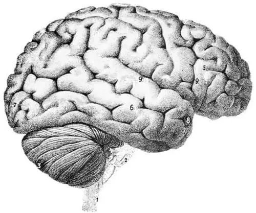 180315 - brain.JPG