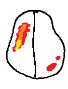 fMRI.png?type=w966