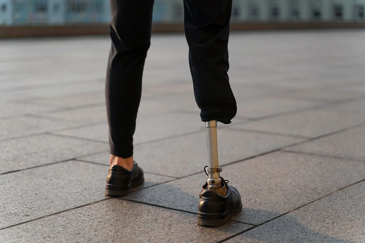 disabled-person-with-amputee-leg.jpg?type=w1200