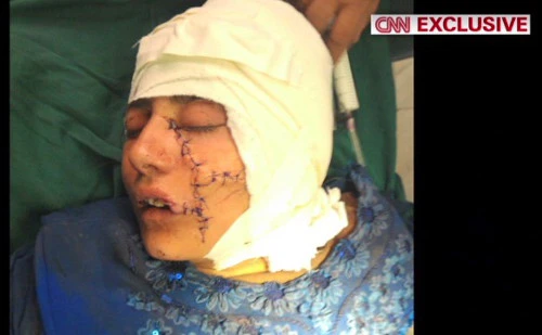 201604031832_11140923484930_1_99_20160403183308.jpg?type=w647