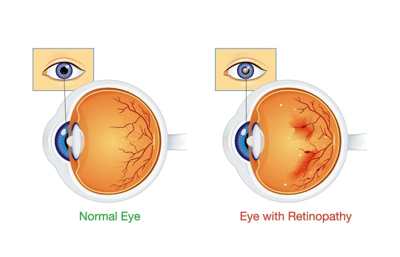 GettyImages-695338058-%EB%B3%80%ED%99%98%EB%90%A8.jpg?type=w1600