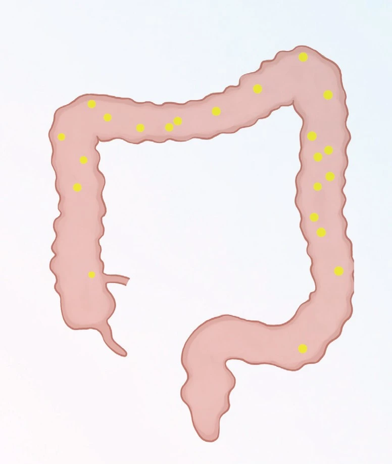 %EB%8B%A4%EC%9D%B4%EC%96%B4%ED%8A%B8.jpg?type=w1600