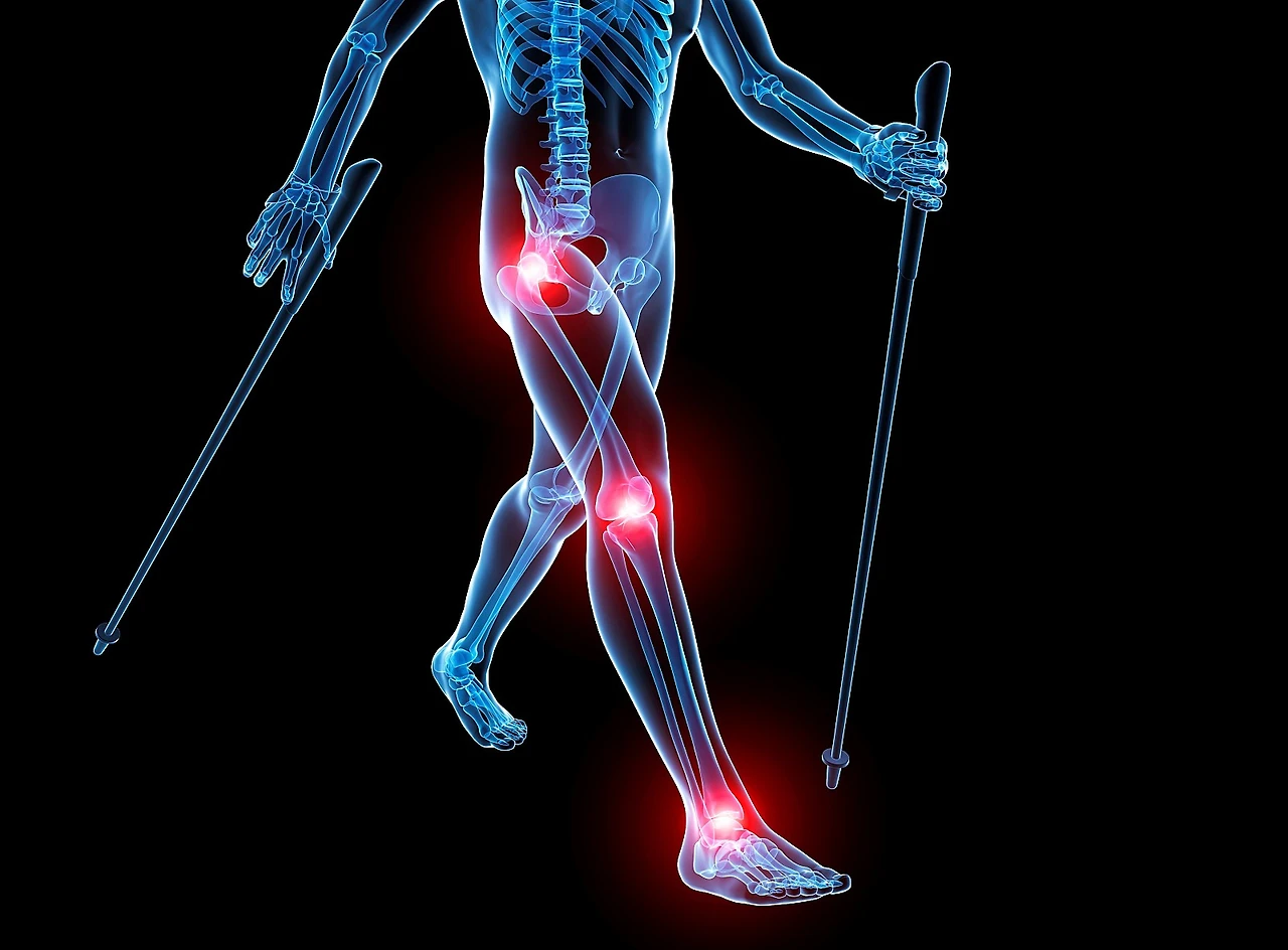 pc004047388.jpg?type=w1600