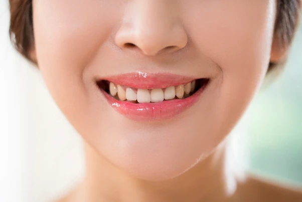 image.png?type=w1600