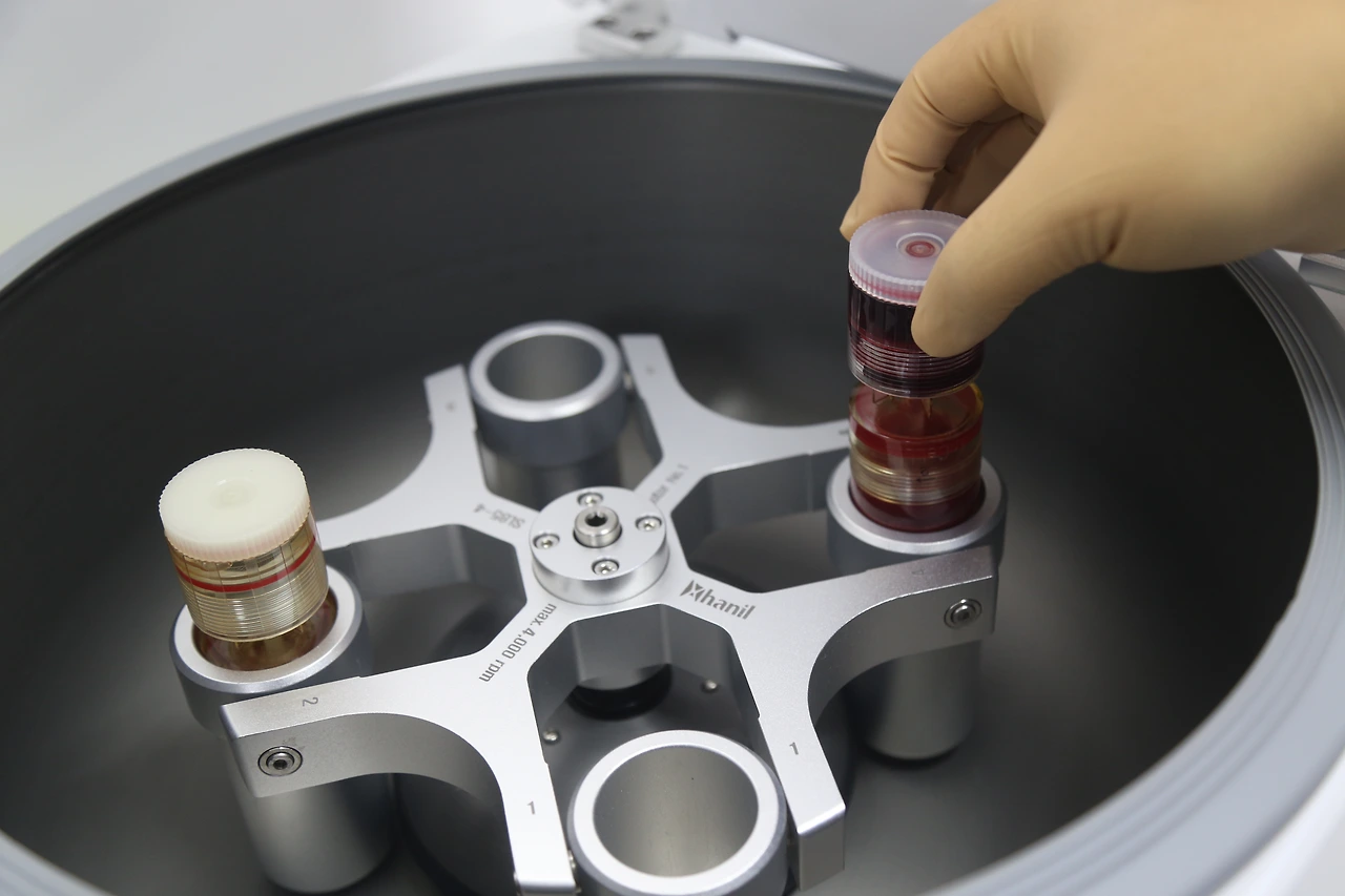 줄기세포 (28).JPG