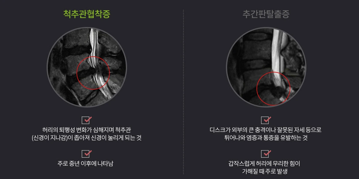 디스크와 차이.PNG