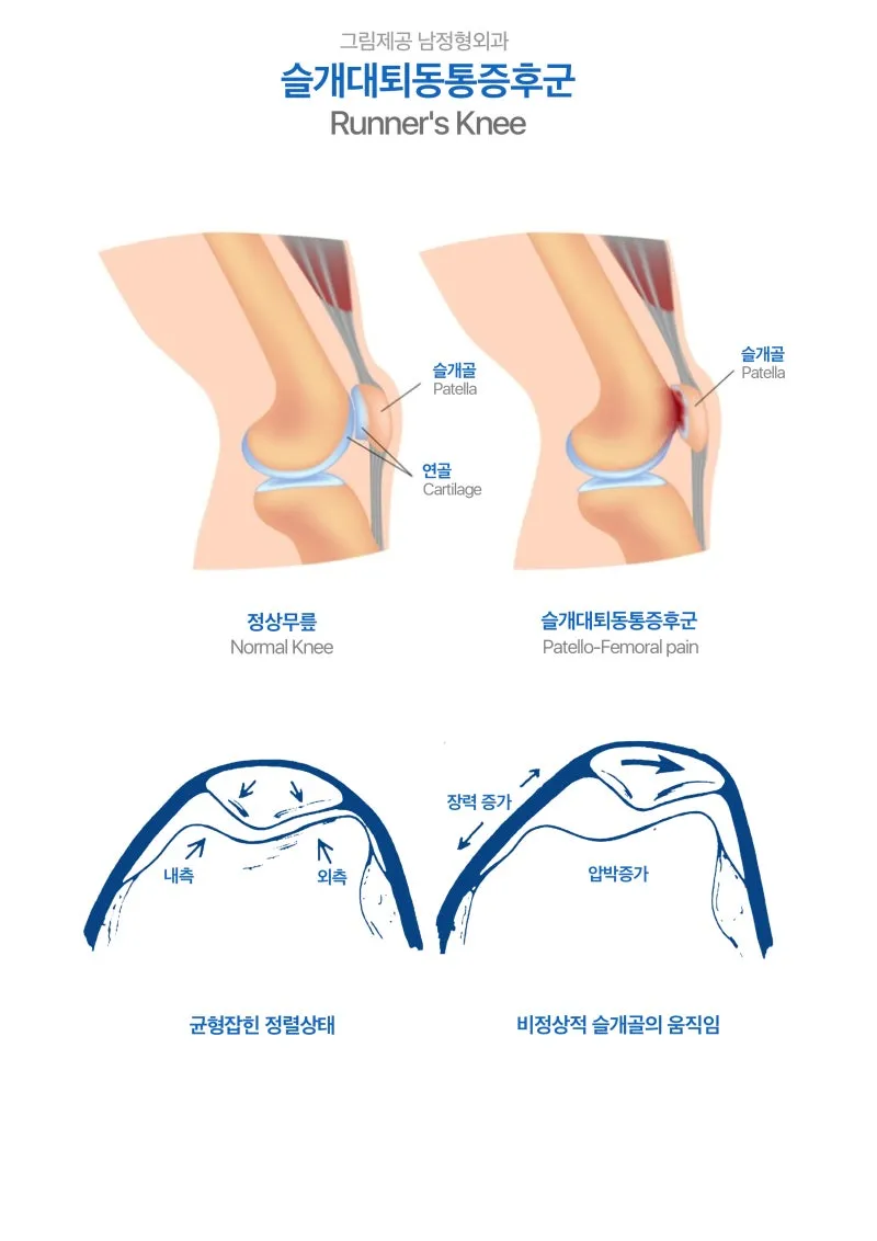 48%EC%8A%AC%EA%B0%9C%EB%8C%80%ED%87%B4%EB%8F%99%ED%86%B5%EC%A6%9D%ED%9B%84%EA%B5%B0.jpg?type=w800