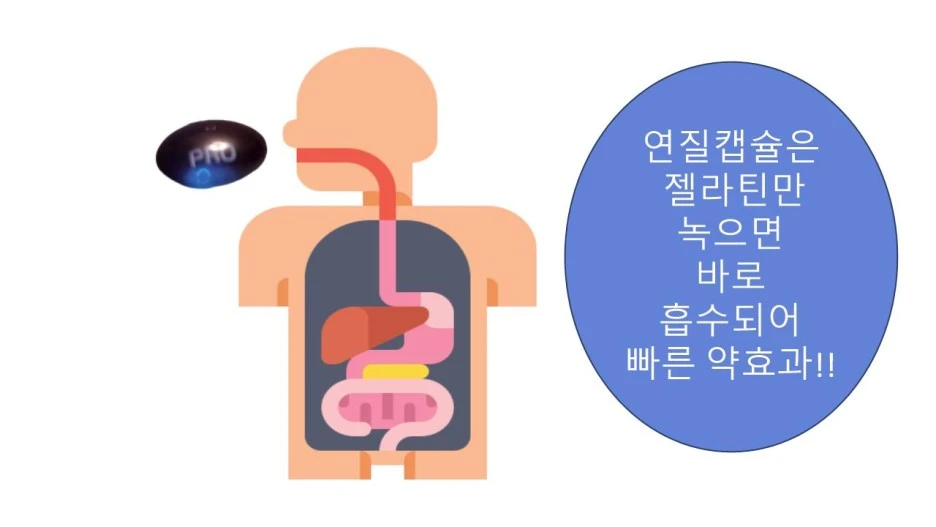 %EC%97%B0%EC%A7%88%EC%BA%A1%EC%8A%90%ED%9A%A8%EA%B3%BC%EC%82%AC%EC%A7%84.jpg?type=w1