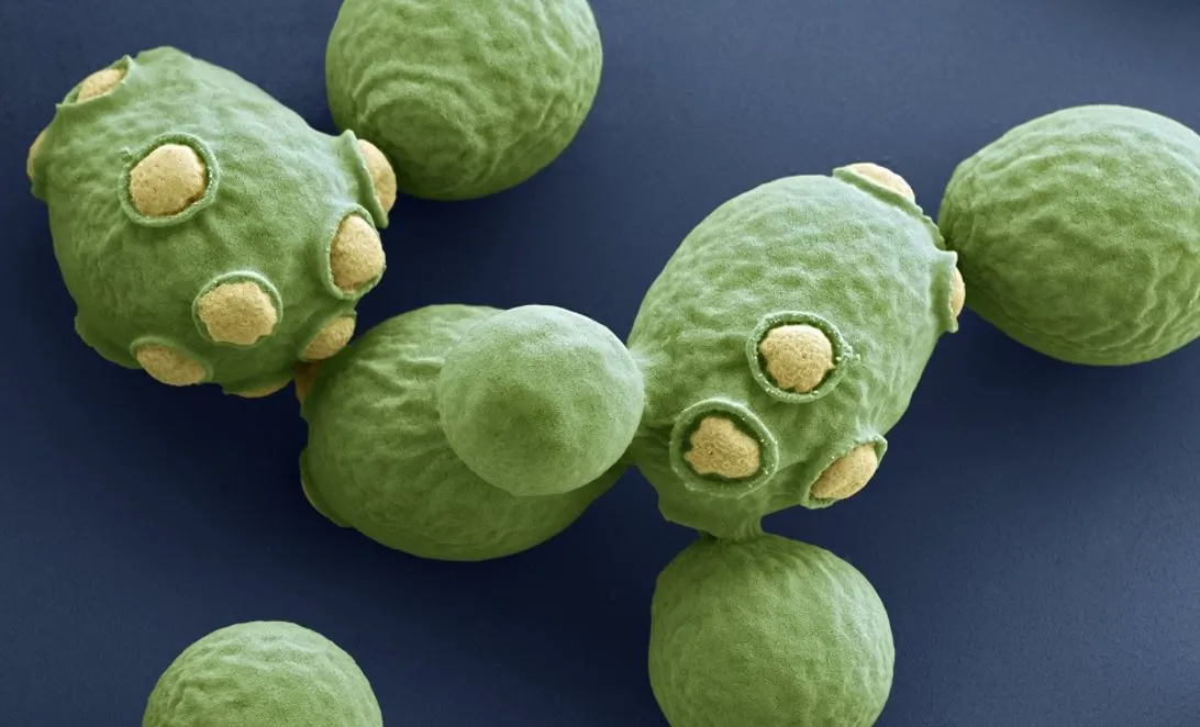 saccharomyces cerevisiae 전자현미경 2.JPG