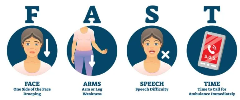 stroke FAST.JPG