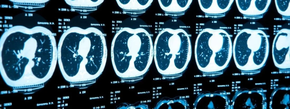 9_aa2Ud018svc1exa1rv8hrsu0_f0tse7.jpg?type=e1920_std