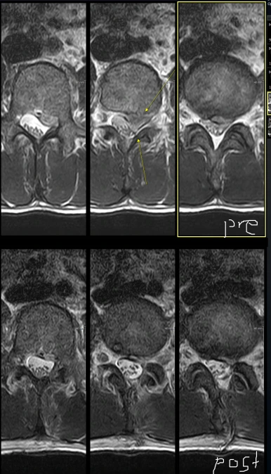 massive_disc_2.png?type=w386