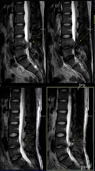 massive_disc_3.png?type=w386