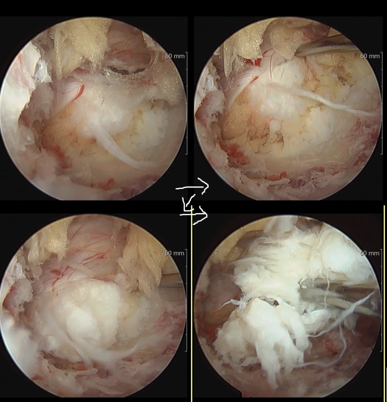 massive_disc.png?type=w773