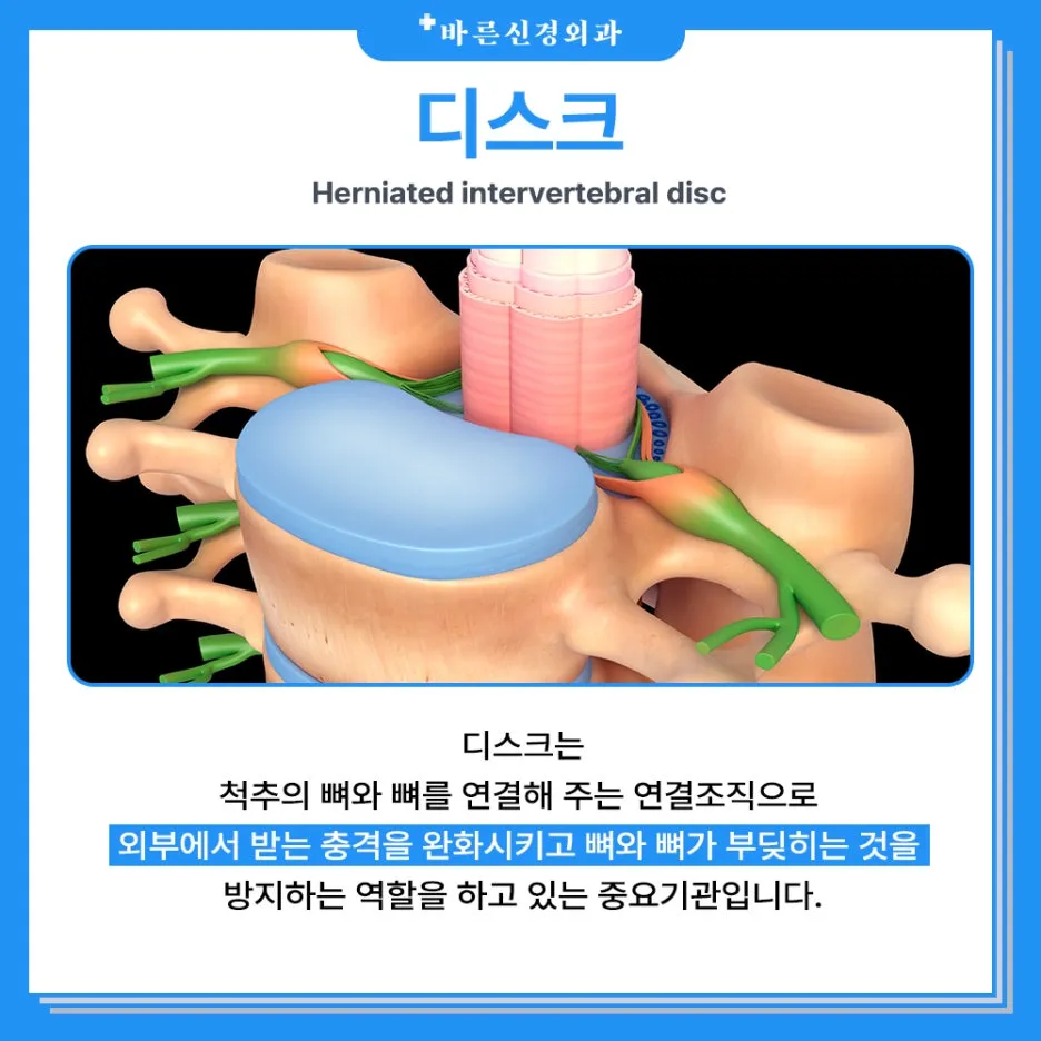 %EB%94%94%EC%8A%A4%ED%81%AC%E3%85%9C.jpg?type=w1