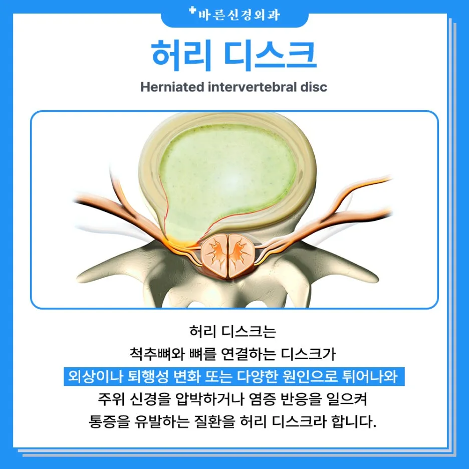 %ED%97%88%EB%A6%AC%EB%94%94%EC%8A%A4%ED%81%AC_(3).jpg?type=w1