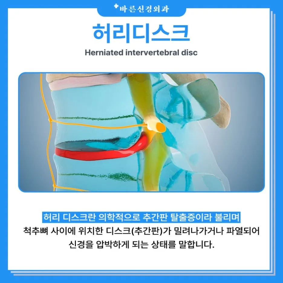 %ED%97%88%EB%A6%AC%EB%94%94%EC%8A%A4%ED%81%AC_(2).jpg?type=w1