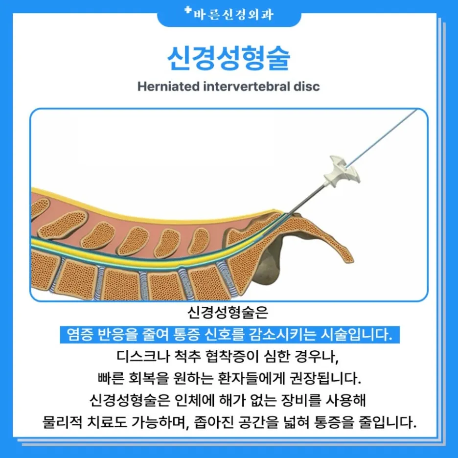 %EC%84%B1%ED%98%95%EC%88%A0_(1).jpg?type=w1