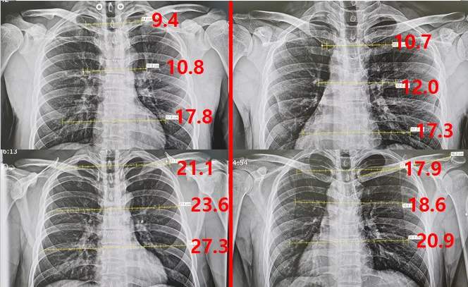 재형 vs 원익.PNG