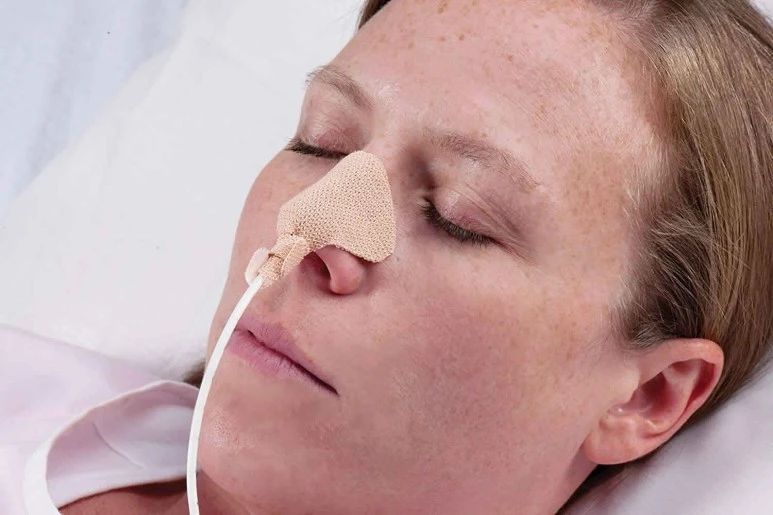 nasogastric-tube.jpg?type=w773