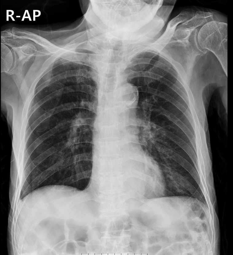 CMC_Talk%EF%BC%BF20240130%EF%BC%BF160431%EF%BC%BF21.png?type=w773