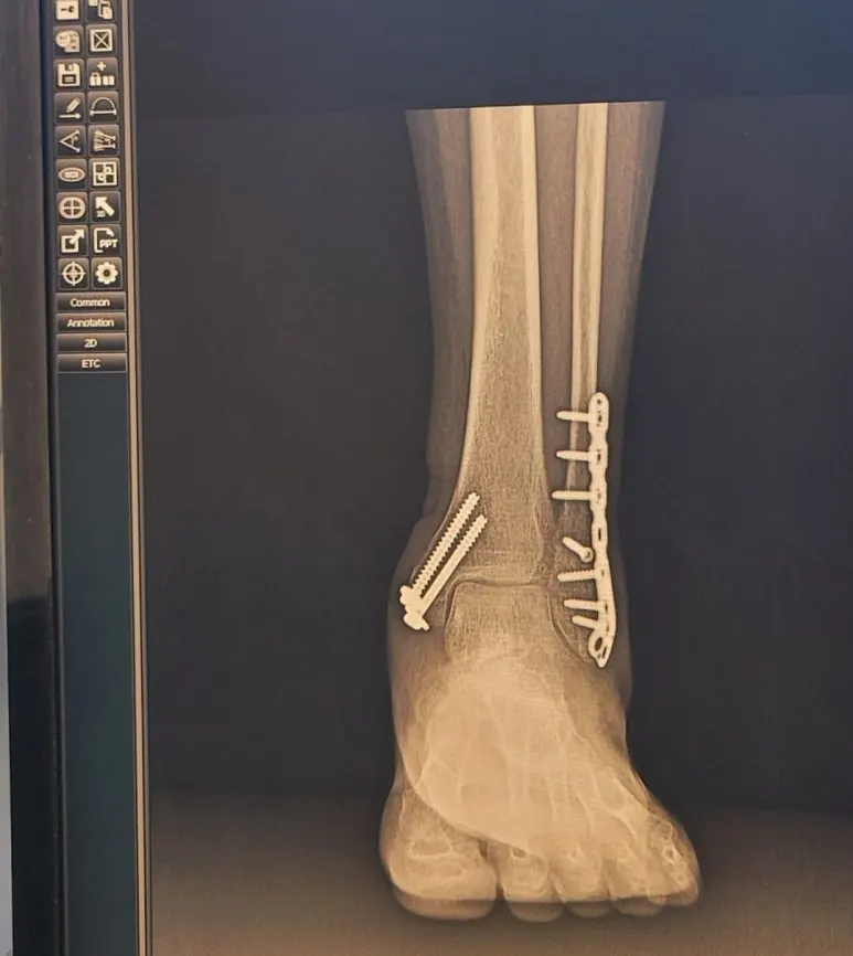 KakaoTalk_20240915_141551685.jpg?type=w773