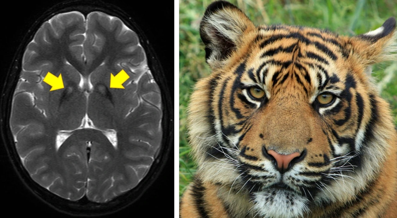 0_9a2Ud018svc1rhn7s2rhuc8l_q49c4t.png?type=e1920_std