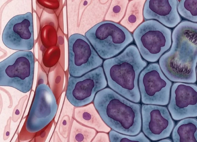 b_7ijUd018svcexnqtlt11bk1_q49c4t.jpg?type=e1280_std