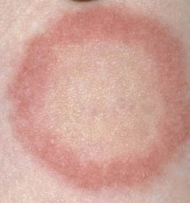 KakaoTalk_20211006_220901302.jpg?type=w1