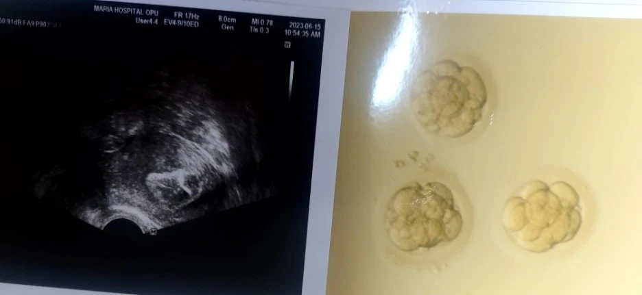 SE-89b05e0d-0f91-48dc-8a8b-a2413dc59de6.jpg?type=w1