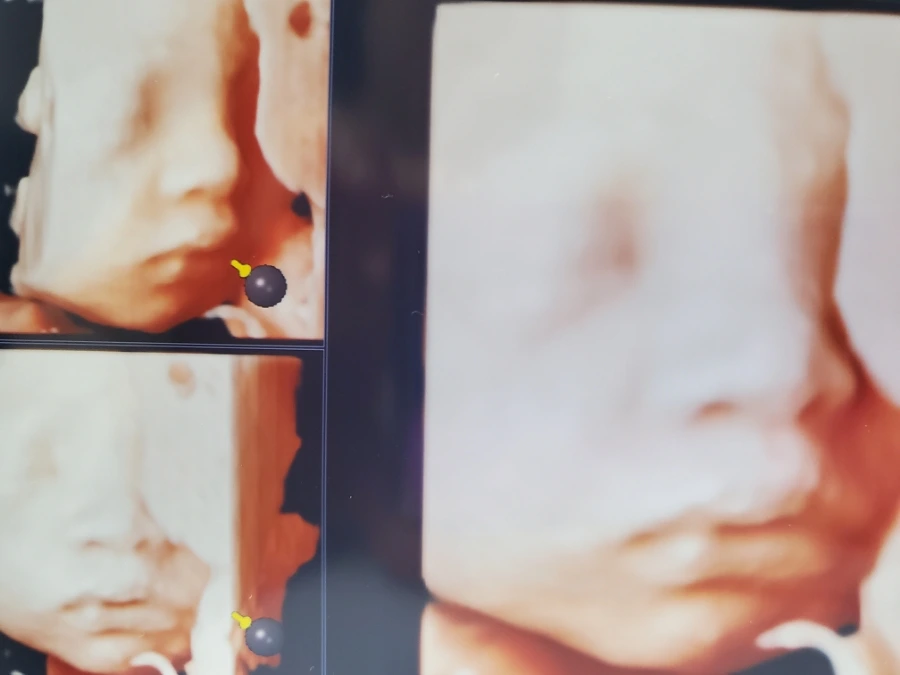 20211129%EF%BC%BF161653.jpg?type=w1