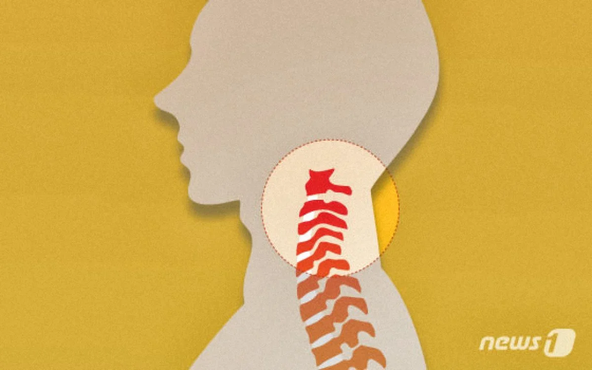 추간판 뉴스1 이미지.jpeg