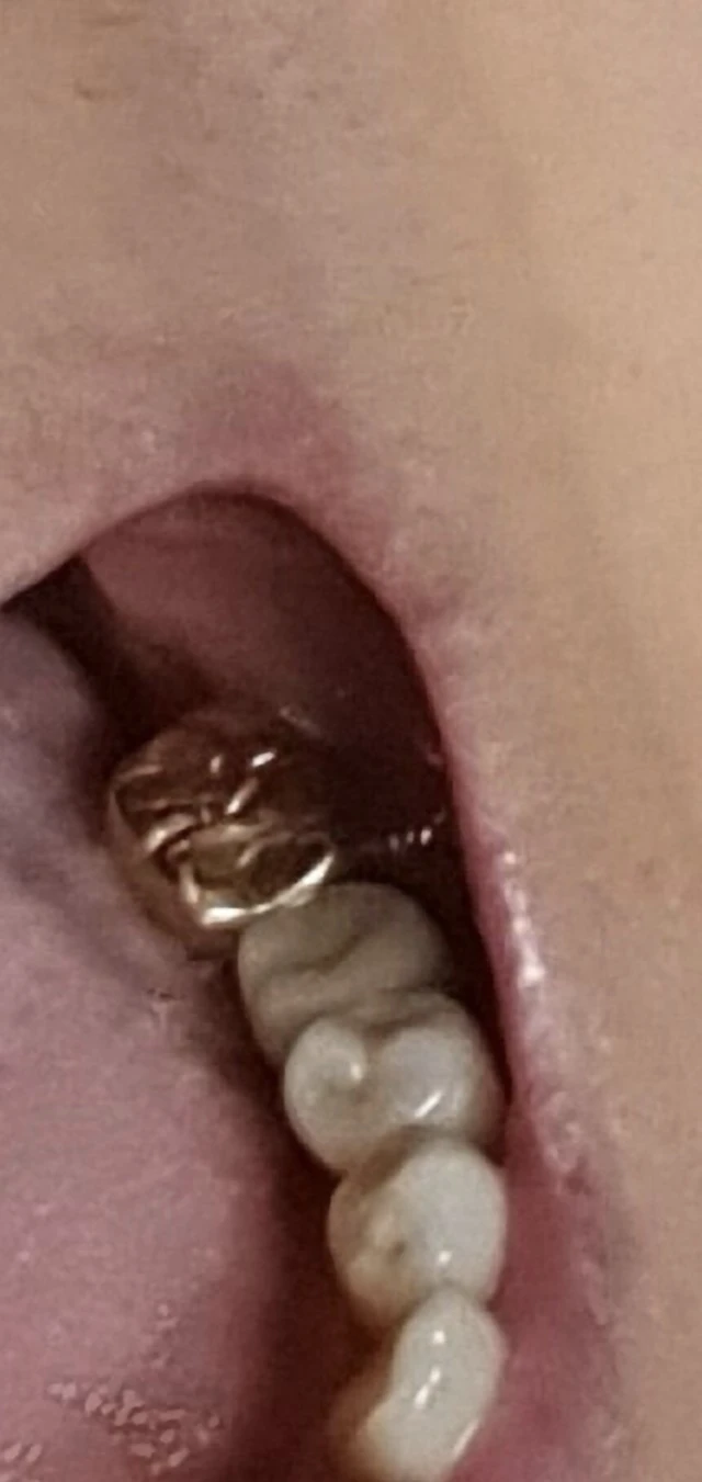 4_2cgUd018svc2baxiegat6ns_bs5d46.jpg?type=e1920_std