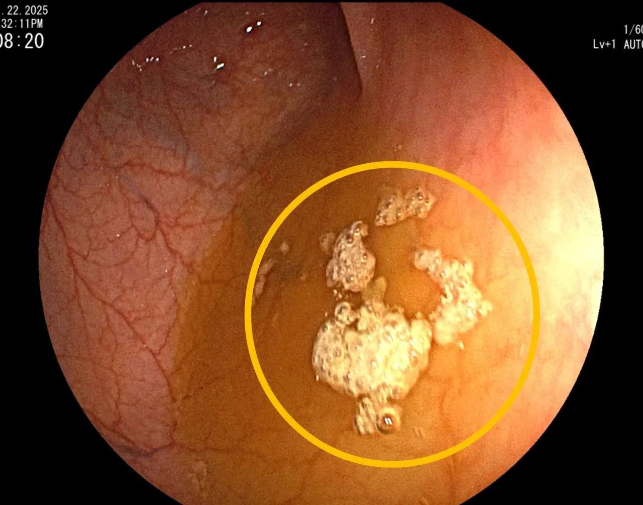 f_3ahUd018svc18u2r6jwnzz03_uhwf7f.jpg?type=e1920_std