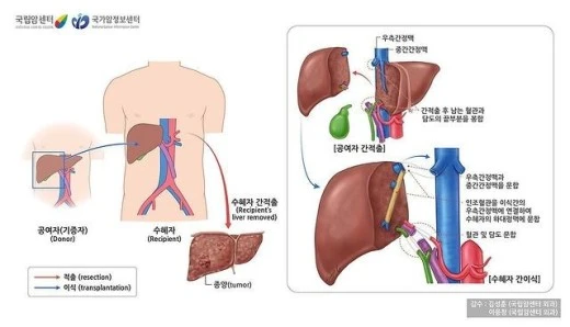 c_g3dUd018svc1ap1fwxy0emos_uhwf7f.jpg?type=w520