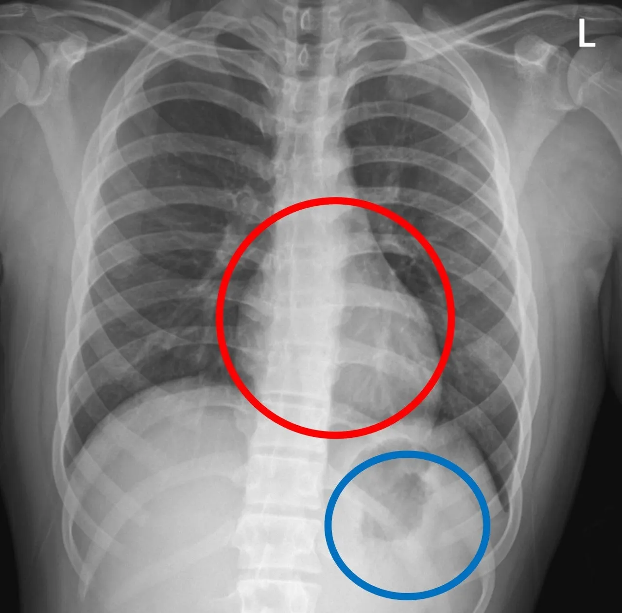 a_8ahUd018svck464wgtm7gg9_uhwf7f.jpg?type=e1920_std