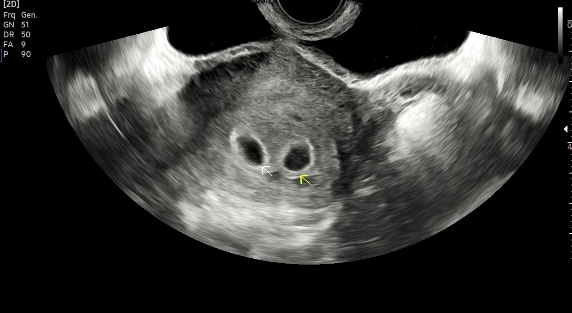 KakaoTalk_Photo_2023-10-28-23-18-12 002.jpeg