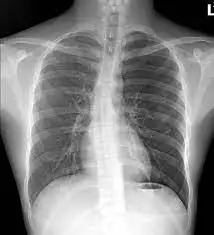 다운로드 (5).jpeg