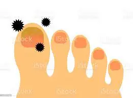 다운로드 (29).jpeg