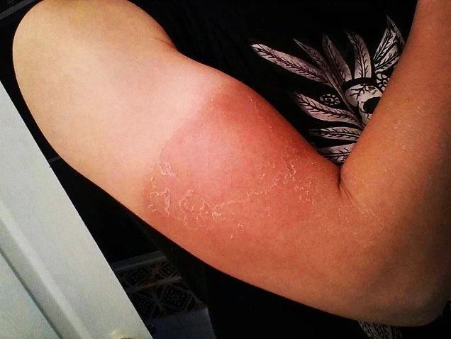 10389597_746618122073194_5012565095006856968_n.jpg?_nc_cat=107&ccb=1-7&_nc_sid=7f8c78&_nc_ohc=3Tj26ivt36AAX_aI9j6&_nc_ht=scontent-ssn1-1.xx&oh=00_AfDuLHZ2aUr7igubOGC97OM07b82-JD40DsHf_mcePFD5Q&oe=65829830