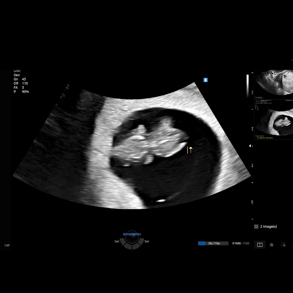 img.png?credential=yqXZFxpELC7KVnFOS48ylbz2pIh7yKj8&expires=1767193199&allow_ip=&allow_referer=&signature=dqW8ao26GVlaxwf%2BO3WelncQZmc%3D