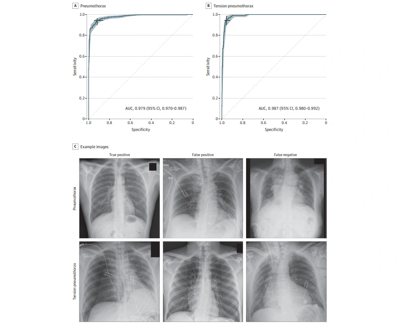 칼럼 이미지 캡처.PNG