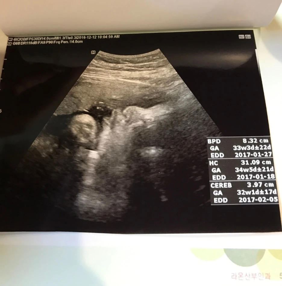 SE-4fce2f10-5b50-4045-83a2-788956db4efe.jpg?type=w1