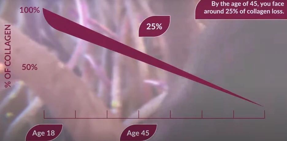 %EB%85%B8%ED%99%94_%EC%BD%9C%EB%9D%BC%EA%B2%90_%EC%A4%84%EC%96%B4%EB%93%A6.png?type=w1