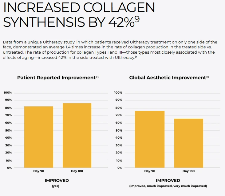 %EC%9A%B8%EC%8E%BC%EB%9D%BC_%EC%9B%90%EB%A6%AC_3.png?type=w1